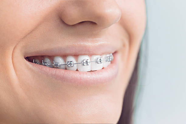Best Wisdom Tooth Removal  in Glasgow, OR